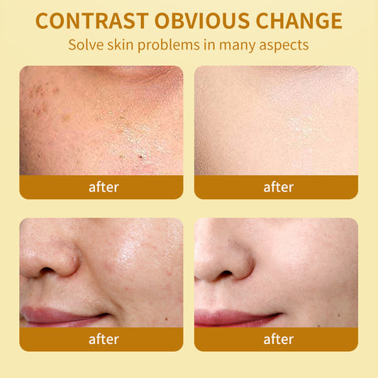 Moisturizing Anti-oxygen Repair Moisturizing Cream