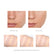 Block defect rods