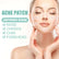 Acne Removing Patch To Fade And Remove Acne